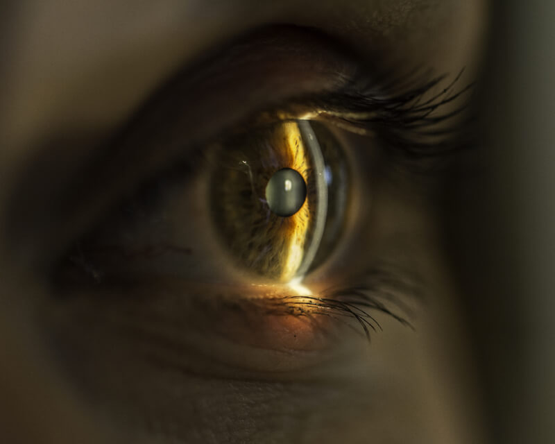 Un avis pour une correction laser